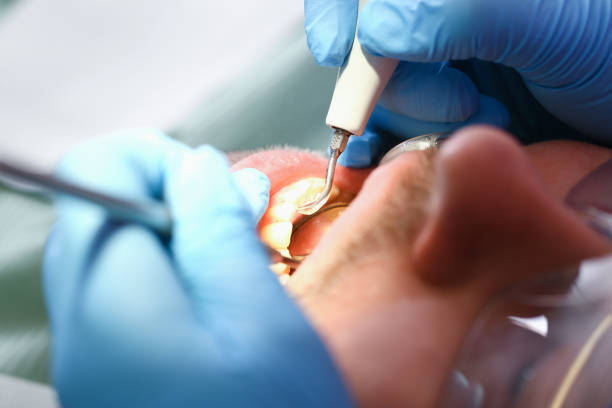 Best Weekend Emergency Dentist in Palmview South, TX
