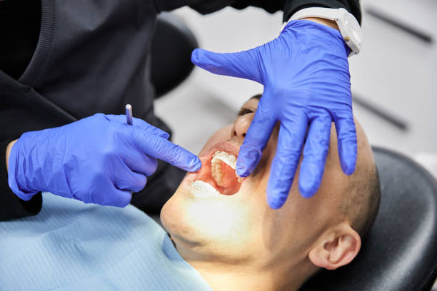 Best Emergency Dental Surgery in Palmview South, TX