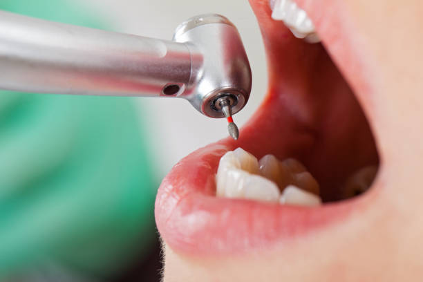 Best Emergency Treatment for Toothache in Palmview South, TX